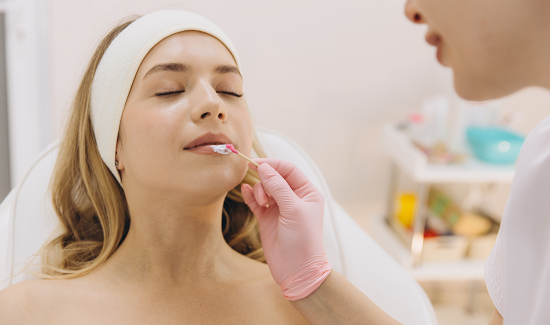 Lip Augmentation